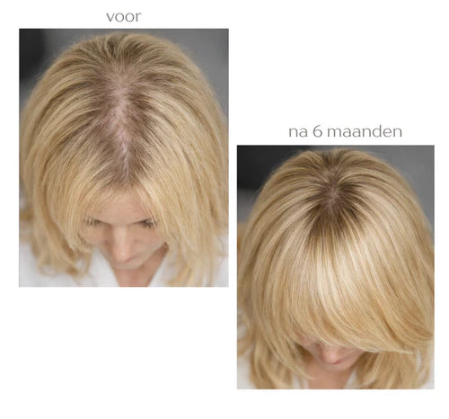 DermaLab - Hair Growth Infusion